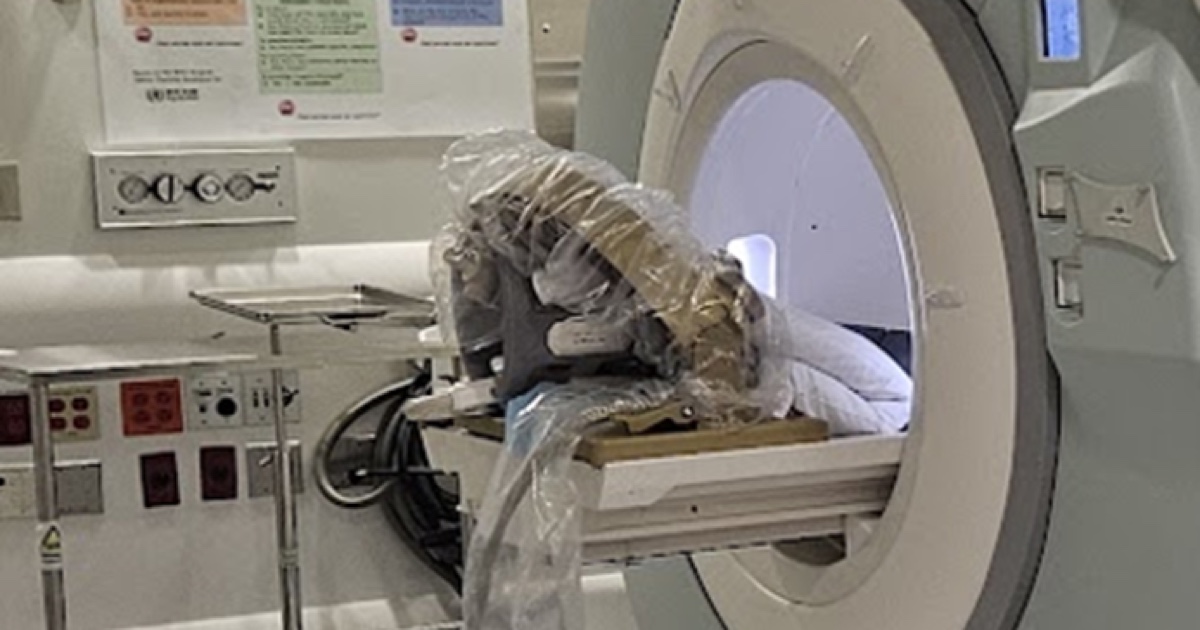 AiM lleva su robot MRI a un ensayo de ablación cerebral